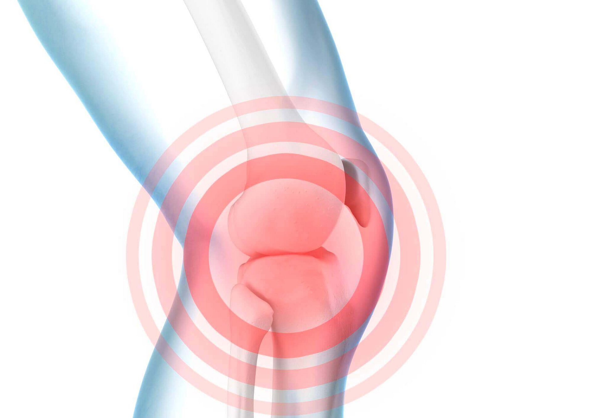 Illustration der Anatomie dies Knies bei Knieschmerzen. Schmerzen im Knie sollten ernstgenommen und mit einem Arzt abgeklärt werden.